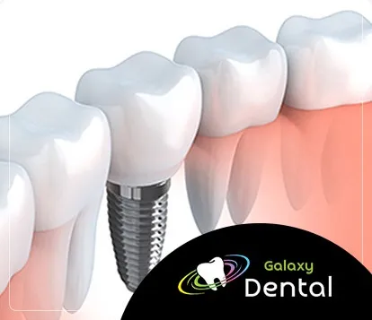 Galaxy Dental